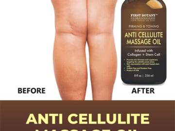 Anti Cellulite Massage Oil Infused w/ Collagen & Stem Cell as low as $13.58 Shipped Free (Reg. $21.95) – Helps Skin Tightening & Stretch Mark treatment