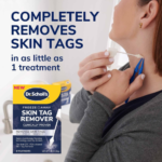 Dr. Scholl’s 8-Count Freeze Away Skin Tag Remover as low as $16.98 Shipped Free (Reg. $20) – $2.12/Treatment
