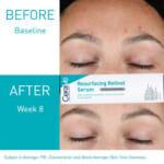 CeraVe Retinol Serum for Post-Acne Marks as low as $8.79 After Coupon (Reg. $22) + Free Shipping