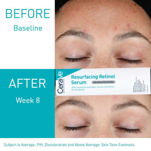 CeraVe Retinol Serum for Post-Acne Marks as low as $8.79 After Coupon (Reg. $22) + Free Shipping